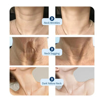Radiant Neck Rejuvenation Mask™